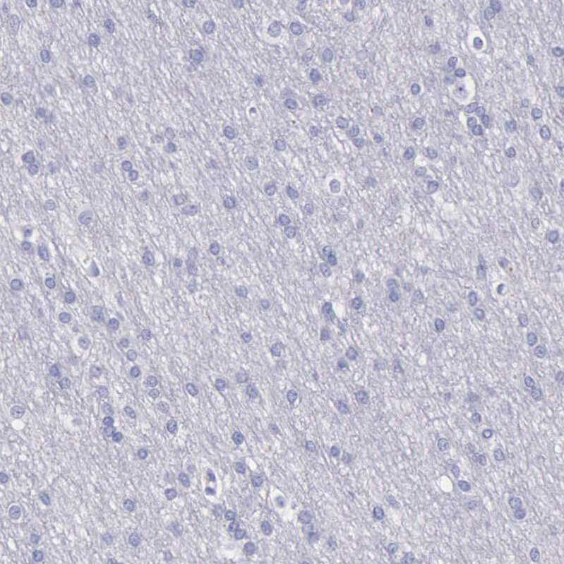 Cystatin A Antibody - BSA Free Immunohistochemistry-Paraffin: Cystatin A Antibody - BSA Free [NBP1-86989]
