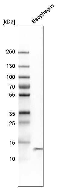 Cystatin A Antibody - BSA Free Western Blot: Cystatin A Antibody - BSA Free [NBP1-86989]