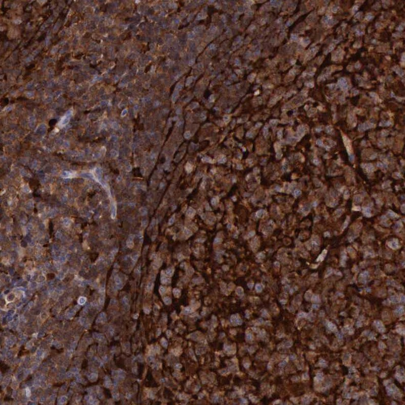 Cystatin A Antibody - BSA Free Immunohistochemistry-Paraffin: Cystatin A Antibody - BSA Free [NBP1-86989]
