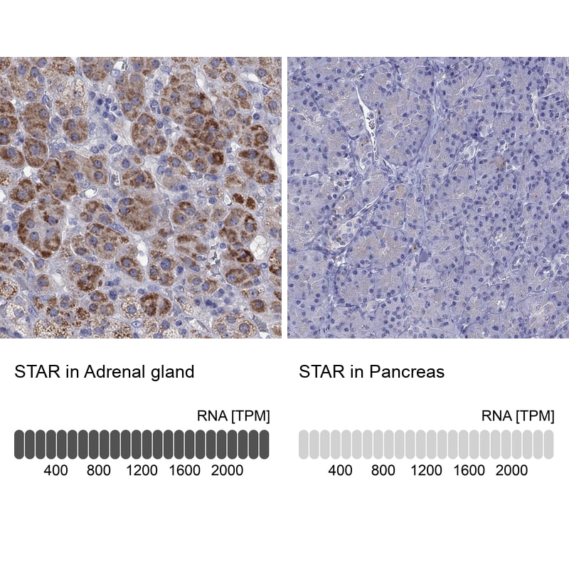 StAR Antibody - BSA Free Immunohistochemistry-Paraffin: StAR Antibody - BSA Free [NBP1-86992]