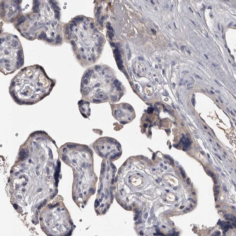 ALDH5A1 Antibody - BSA Free Immunohistochemistry-Paraffin: ALDH5A1 Antibody - BSA Free [NBP1-86996]