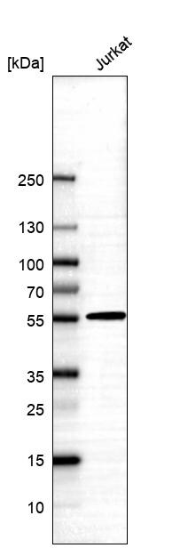 ALDH5A1 Antibody - BSA Free Western Blot: ALDH5A1 Antibody - BSA Free [NBP1-86996]
