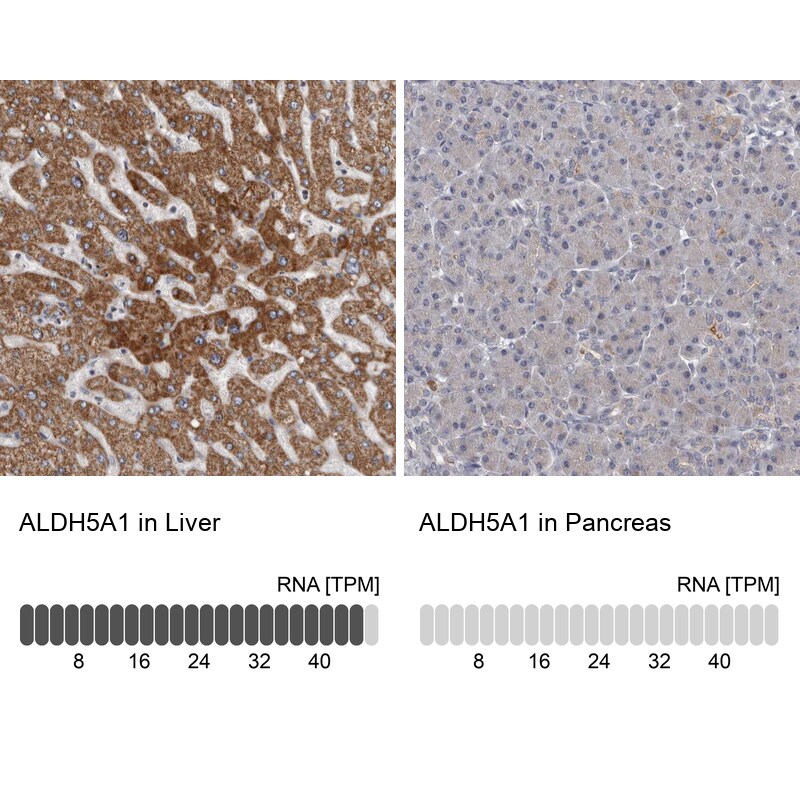 ALDH5A1 Antibody - BSA Free Immunohistochemistry-Paraffin: ALDH5A1 Antibody [NBP1-86997]