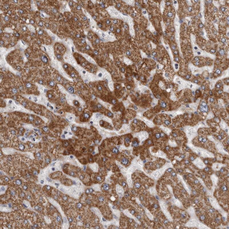 ALDH5A1 Antibody - BSA Free Immunohistochemistry-Paraffin: ALDH5A1 Antibody [NBP1-86997]