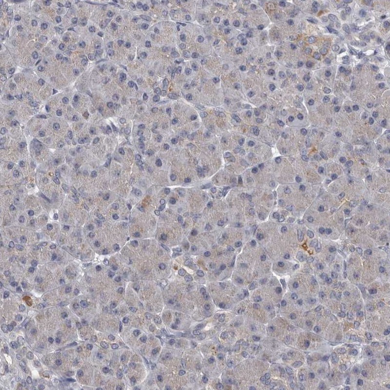 ALDH5A1 Antibody - BSA Free Immunohistochemistry-Paraffin: ALDH5A1 Antibody [NBP1-86997]