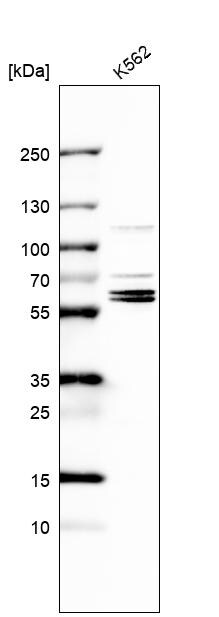 TROVE2 Antibody - BSA Free Western Blot: TROVE2 Antibody - BSA Free [NBP1-86998]