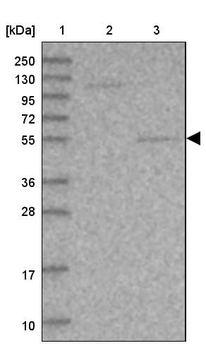SRPX2 Antibody - BSA Free Western Blot: SRPX2 Antibody - BSA Free [NBP1-86999]