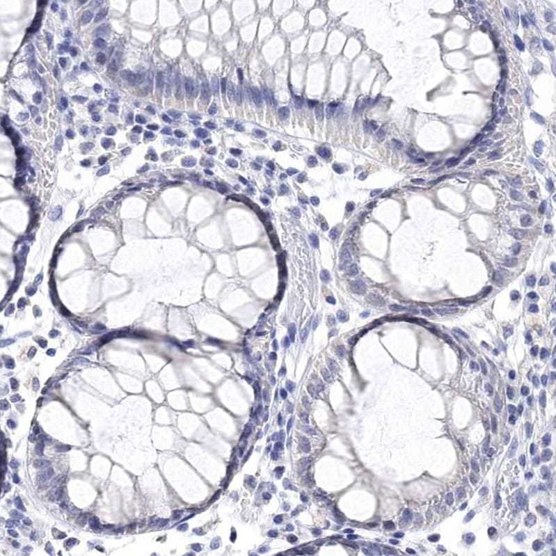 Synaptotagmin 12 Antibody - BSA Free Immunohistochemistry-Paraffin: Synaptotagmin 12 Antibody - BSA Free [NBP1-87001]