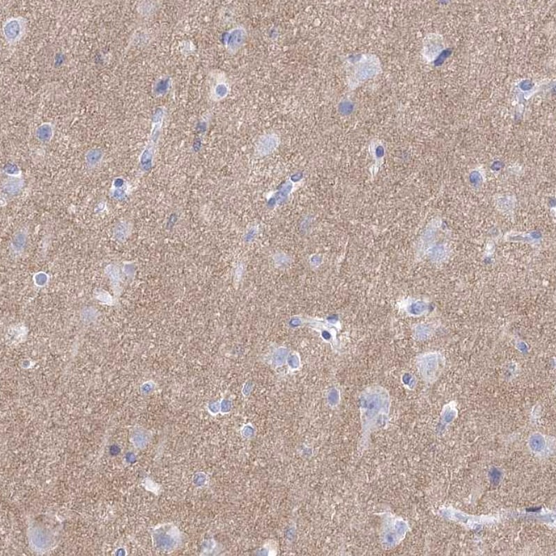Synaptotagmin 12 Antibody - BSA Free Immunohistochemistry-Paraffin: Synaptotagmin 12 Antibody - BSA Free [NBP1-87001]