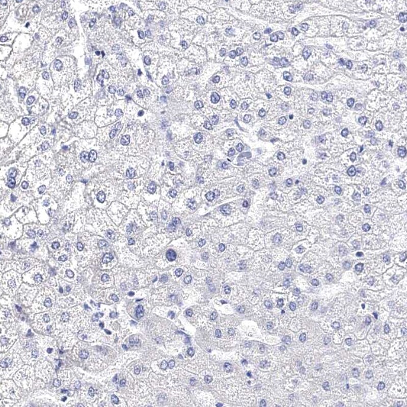 Synaptotagmin 12 Antibody - BSA Free Immunohistochemistry-Paraffin: Synaptotagmin 12 Antibody - BSA Free [NBP1-87001]