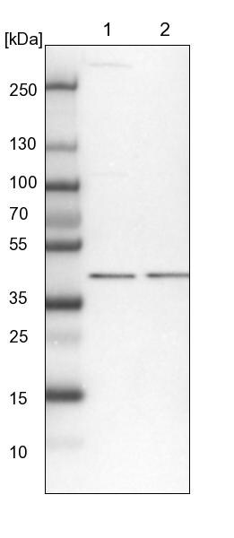 SEPHS1 Antibody - BSA Free Western Blot: SEPHS1 Antibody - BSA Free [NBP1-87008]