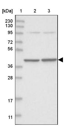 SEPHS1 Antibody - BSA Free Western Blot: SEPHS1 Antibody - BSA Free [NBP1-87008]