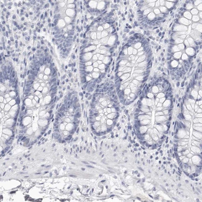Lactoperoxidase Antibody - BSA Free Immunohistochemistry: Lactoperoxidase Antibody - BSA Free [NBP1-87010]