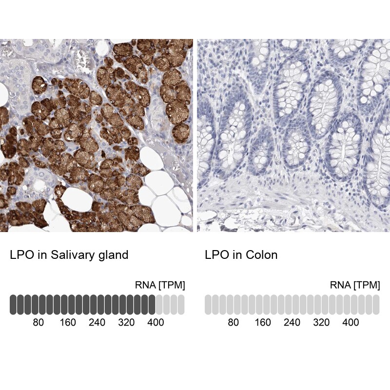 Lactoperoxidase Antibody - BSA Free Immunohistochemistry: Lactoperoxidase Antibody - BSA Free [NBP1-87010]