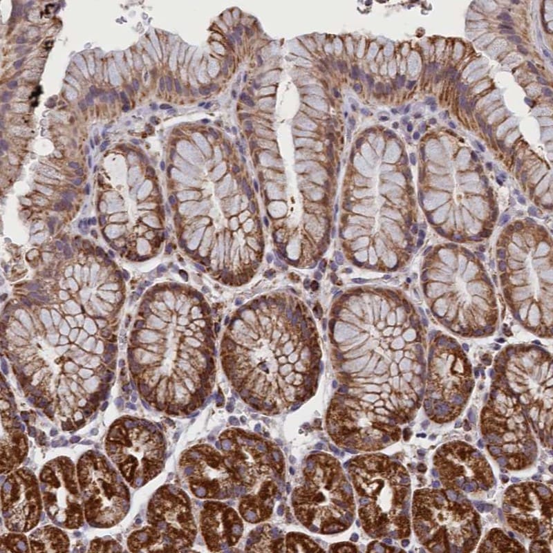 IFT122 Antibody - BSA Free Immunohistochemistry-Paraffin: IFT122 Antibody - BSA Free [NBP1-87014]
