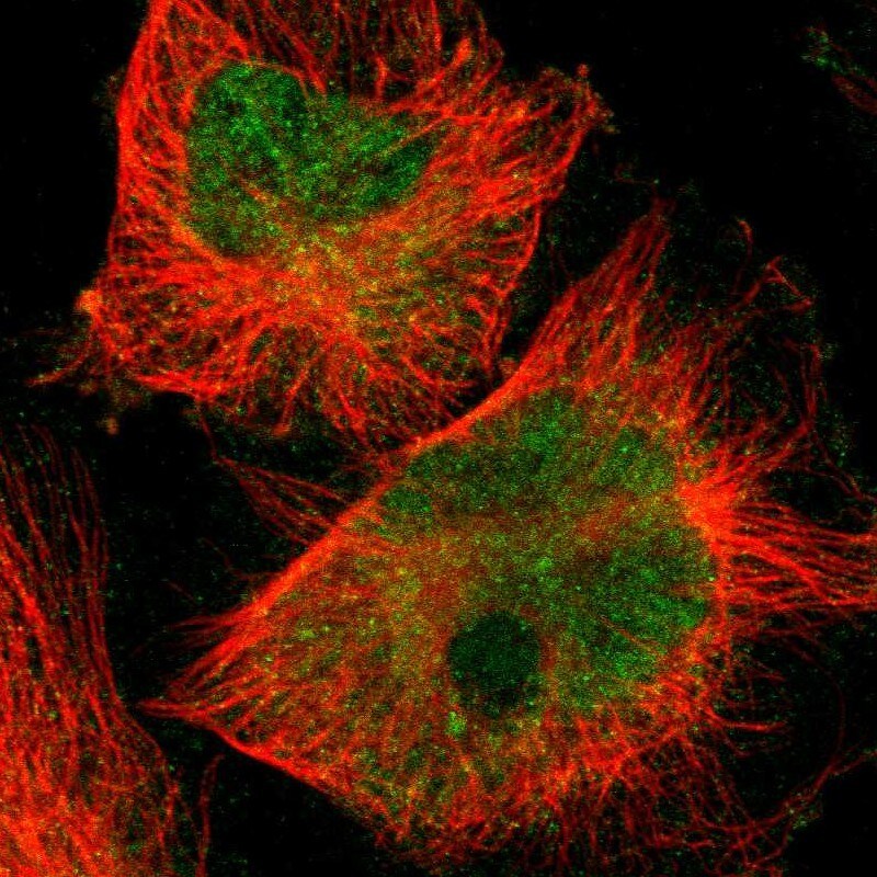 SnoN Antibody - BSA Free Immunohistochemistry-Paraffin: SnoN Antibody - BSA Free [NBP1-87020]