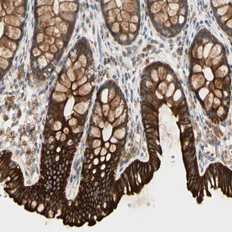 SnoN Antibody - BSA Free Immunohistochemistry-Paraffin: SnoN Antibody - BSA Free [NBP1-87020]