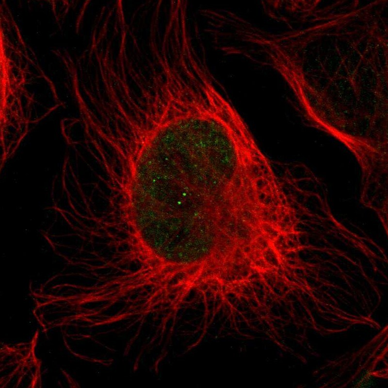 Myosin heavy chain 11 Antibody - BSA Free Immunohistochemistry-Paraffin: Myosin heavy chain 11 Antibody - BSA Free [NBP1-87025]