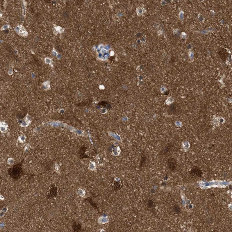 RAP1GDS1 Antibody - BSA Free Immunohistochemistry-Paraffin: RAP1GDS1 Antibody - BSA Free [NBP1-87027]