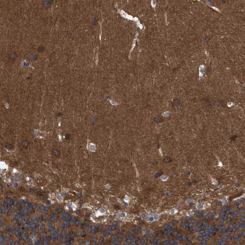 RAP1GDS1 Antibody - BSA Free Immunohistochemistry-Paraffin: RAP1GDS1 Antibody - BSA Free [NBP1-87027]