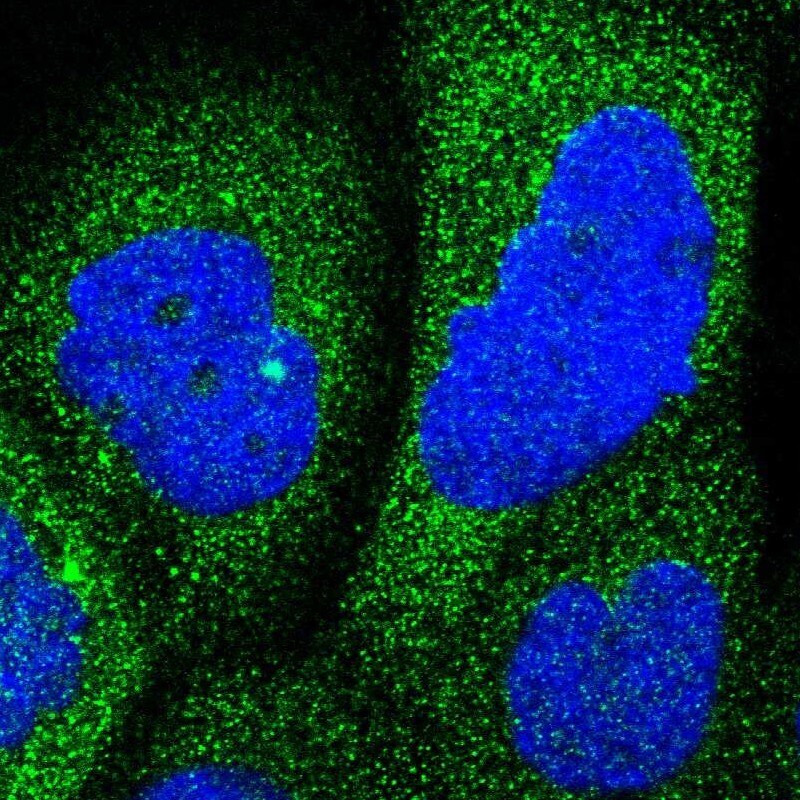 RAP1GDS1 Antibody - BSA Free Immunohistochemistry-Paraffin: RAP1GDS1 Antibody - BSA Free [NBP1-87027]