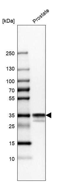 Calponin 1 Antibody - BSA Free Western Blot: Calponin 1 Antibody - BSA Free [NBP1-87029]