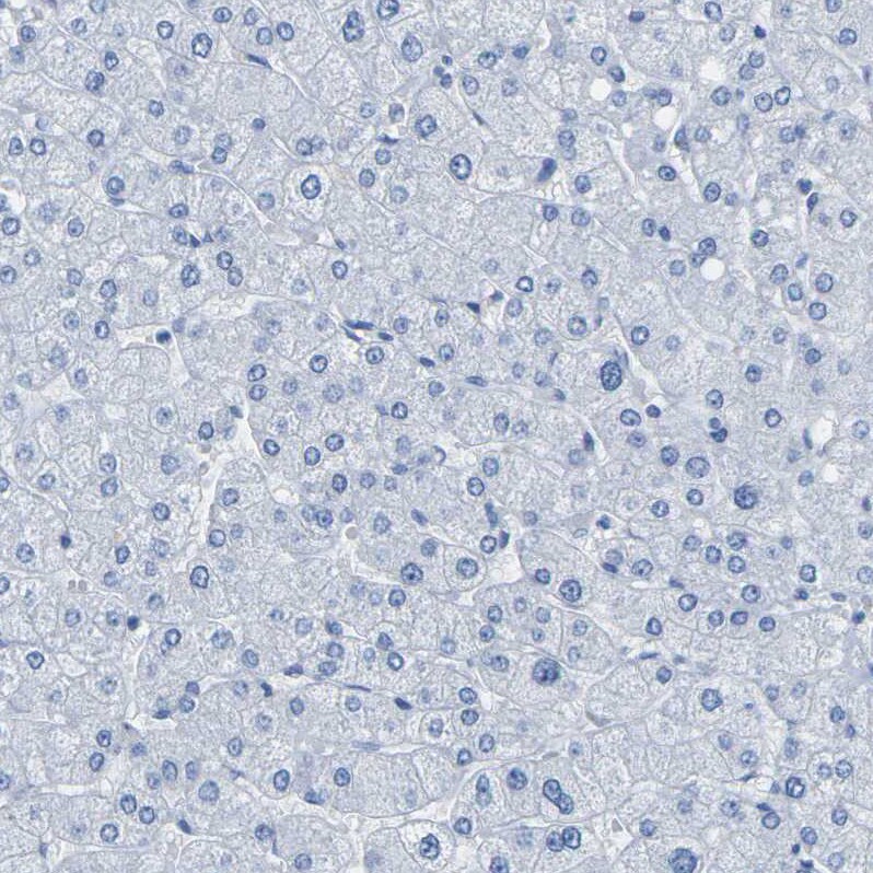 Calponin 1 Antibody - BSA Free Immunohistochemistry-Paraffin: Calponin 1 Antibody - BSA Free [NBP1-87029]