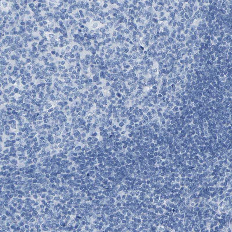 Calponin 1 Antibody - BSA Free Immunohistochemistry-Paraffin: Calponin 1 Antibody - BSA Free [NBP1-87029]