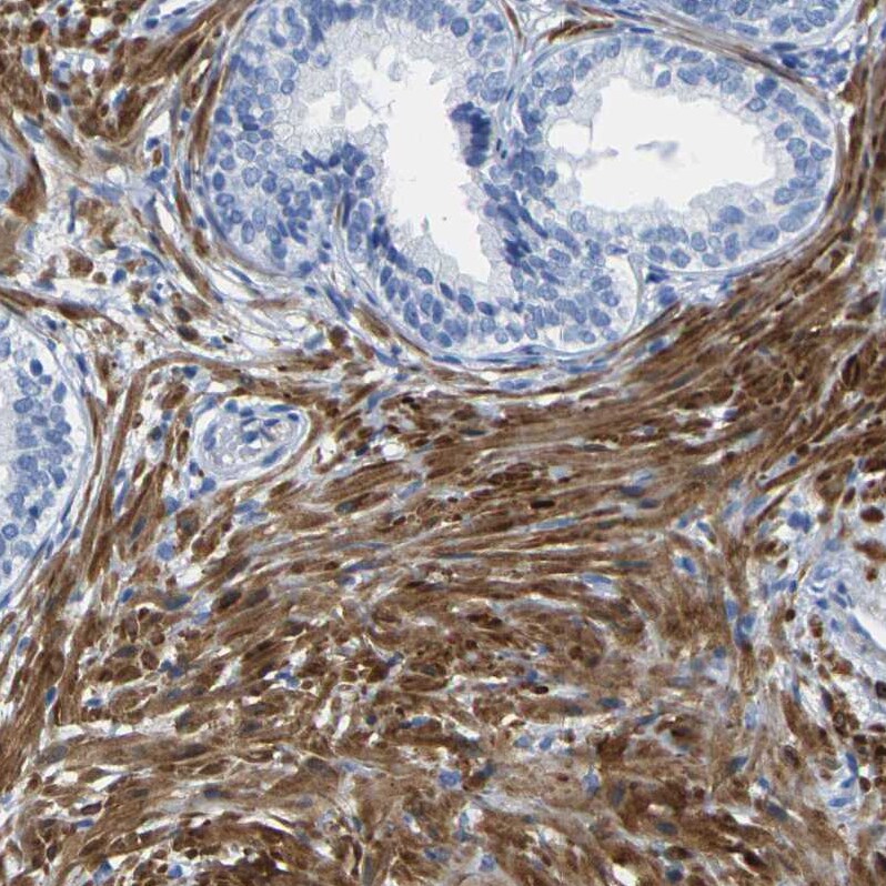 Calponin 1 Antibody - BSA Free Immunohistochemistry-Paraffin: Calponin 1 Antibody - BSA Free [NBP1-87029]