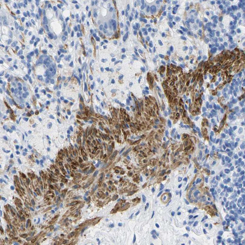 Calponin 1 Antibody - BSA Free Immunohistochemistry-Paraffin: Calponin 1 Antibody - BSA Free [NBP1-87029]