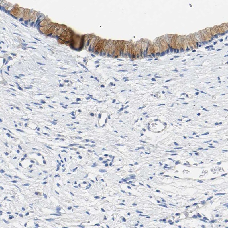 Chondroadherin Antibody - BSA Free Immunohistochemistry: Chondroadherin Antibody - BSA Free [NBP1-87031]