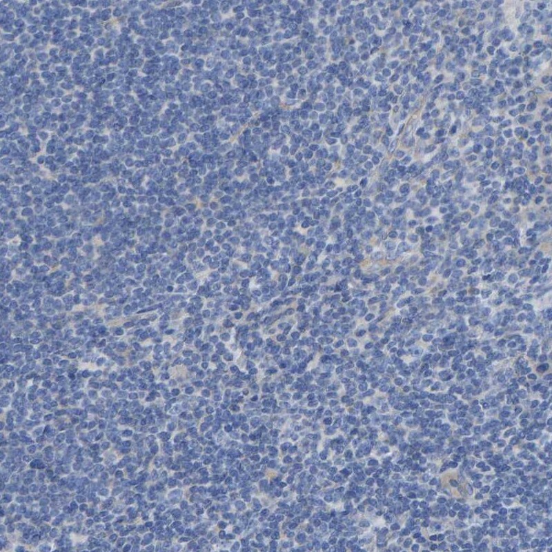 Chondroadherin Antibody - BSA Free Immunohistochemistry: Chondroadherin Antibody - BSA Free [NBP1-87031]