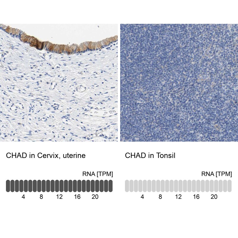 Chondroadherin Antibody - BSA Free Immunohistochemistry: Chondroadherin Antibody - BSA Free [NBP1-87031]