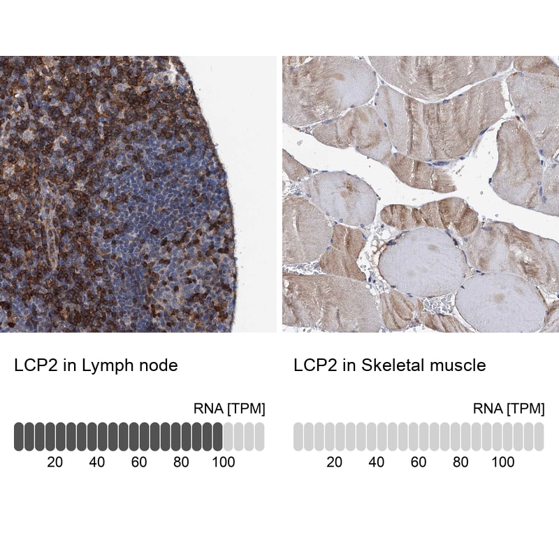 SLP-76/LCP2 Antibody - BSA Free Immunohistochemistry-Paraffin: SLP-76/LCP2 Antibody [NBP1-87033]