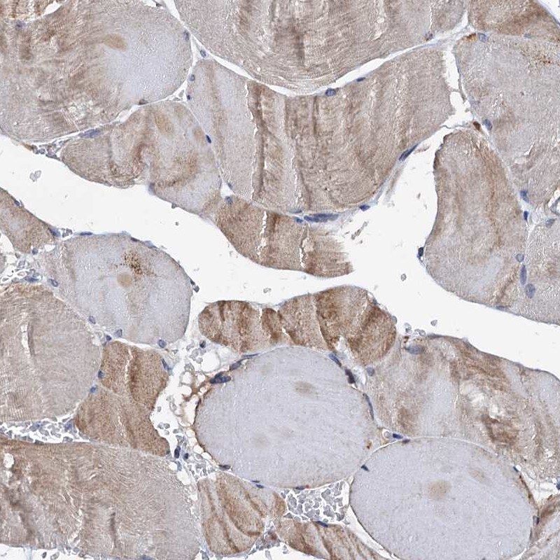 SLP-76/LCP2 Antibody - BSA Free Immunohistochemistry-Paraffin: SLP-76/LCP2 Antibody [NBP1-87033]