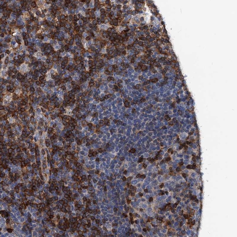 SLP-76/LCP2 Antibody - BSA Free Immunohistochemistry-Paraffin: SLP-76/LCP2 Antibody [NBP1-87033]