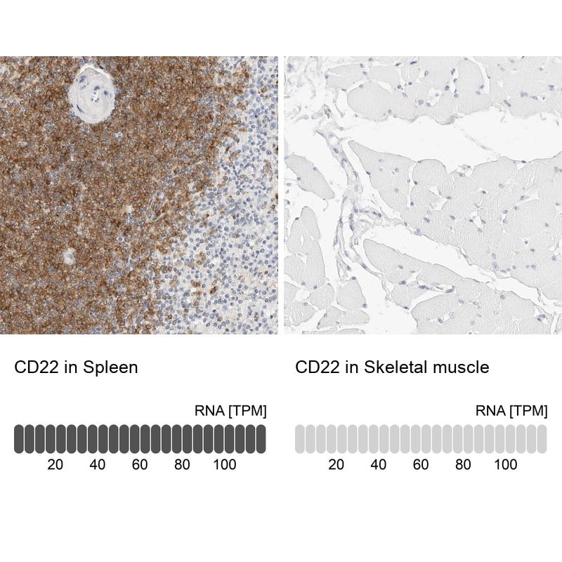 Siglec-2/CD22 Antibody - BSA Free Immunohistochemistry-Paraffin: Siglec-2/CD22 Antibody - BSA Free [NBP1-87041]