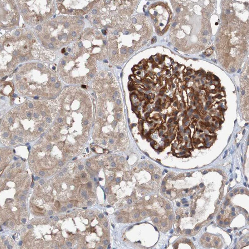 ST8SIA-VI Antibody - BSA Free Immunohistochemistry-Paraffin: ST8SIA-VI Antibody - BSA Free [NBP1-87042]