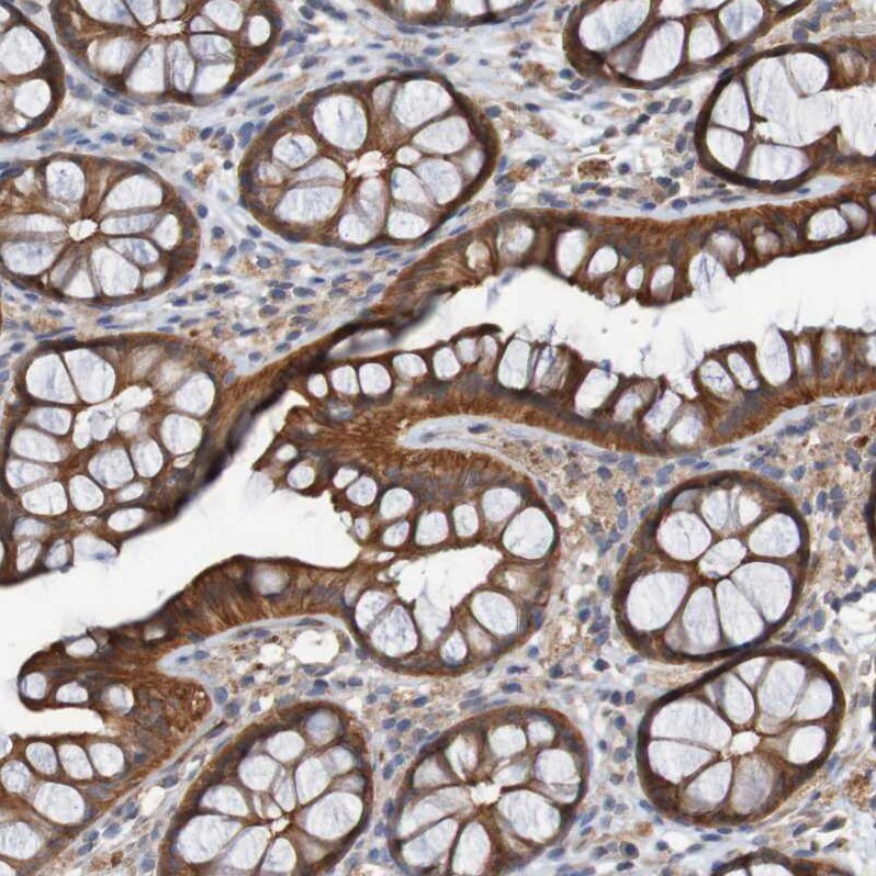 ST8SIA-VI Antibody - BSA Free Immunohistochemistry-Paraffin: ST8SIA-VI Antibody - BSA Free [NBP1-87042]