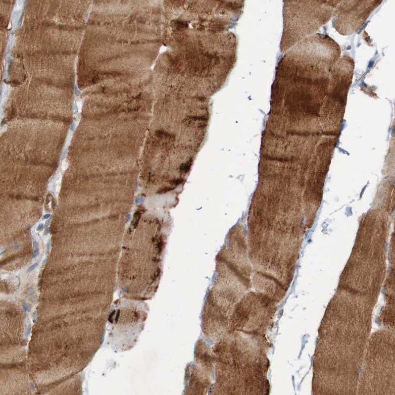 ST8SIA-VI Antibody - BSA Free Immunohistochemistry-Paraffin: ST8SIA-VI Antibody - BSA Free [NBP1-87042]