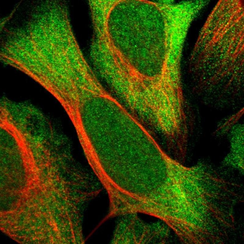SRPK2 Antibody - BSA Free Immunohistochemistry-Paraffin: SRPK2 Antibody - BSA Free [NBP1-87048]