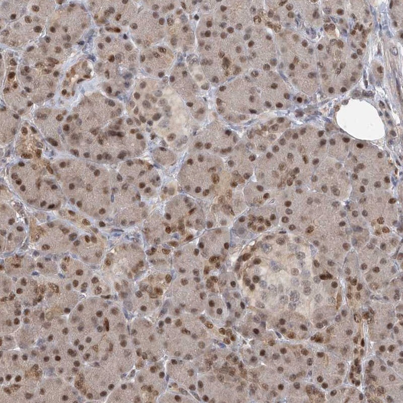 PMM1/Phosphomannomutase 1 Antibody - BSA Free Immunohistochemistry-Paraffin: PMM1/Phosphomannomutase 1 Antibody [NBP1-87055]