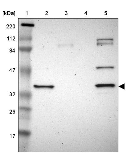 SDSL Antibody - BSA Free Western Blot: SDSL Antibody - BSA Free [NBP1-87058]