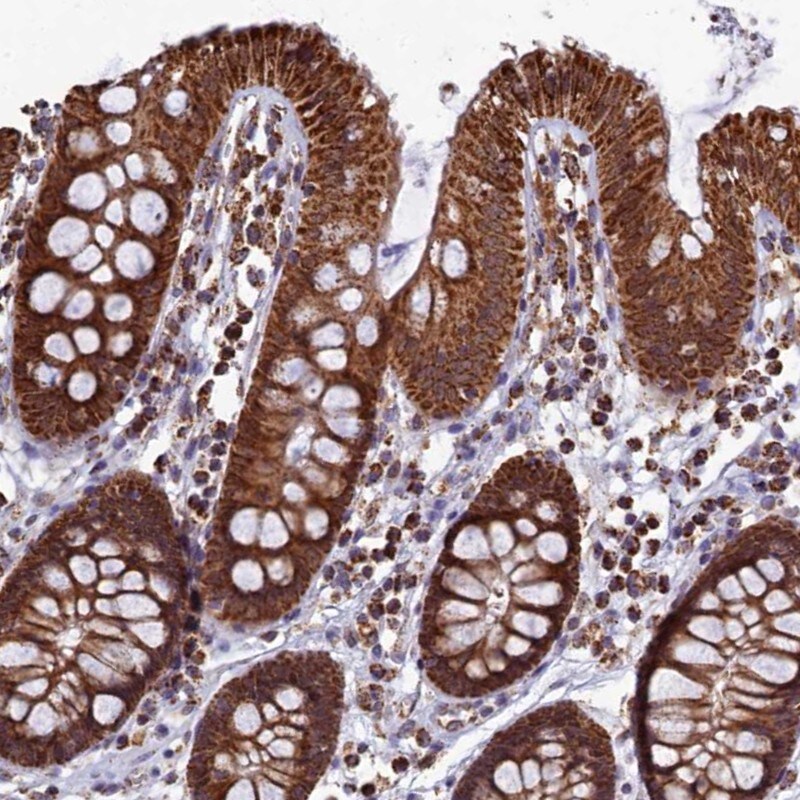 SPR Antibody - BSA Free Immunohistochemistry-Paraffin: SPR Antibody - BSA Free [NBP1-87060]