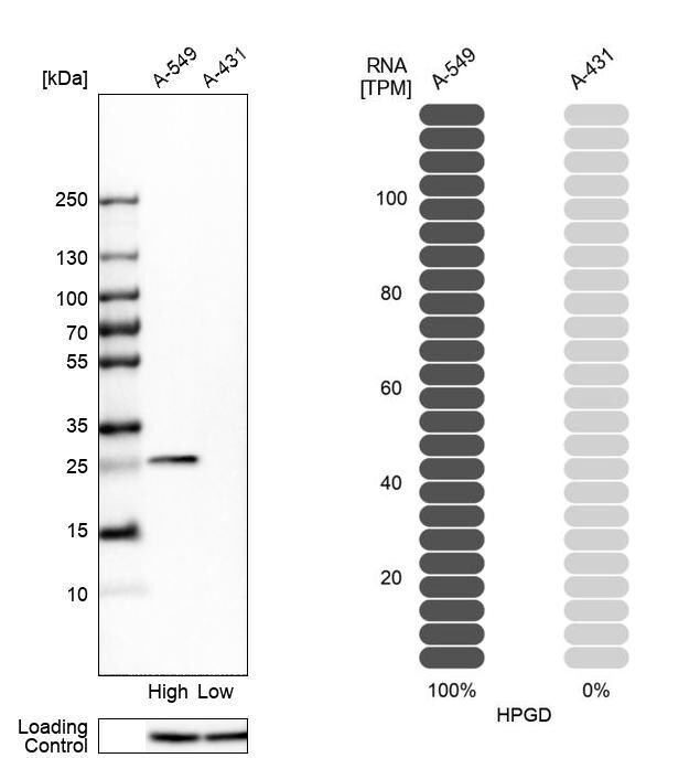 15-PGDH/HPGD Antibody - BSA Free Western Blot: 15-PGDH/HPGD Antibody - BSA Free [NBP1-87061]