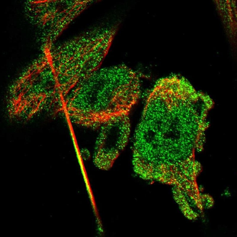 CBR3 Antibody - BSA Free Immunohistochemistry-Paraffin: CBR3 Antibody - BSA Free [NBP1-87065]