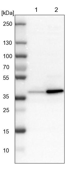 GALE Antibody - BSA Free Western Blot: GALE Antibody - BSA Free [NBP1-87066]