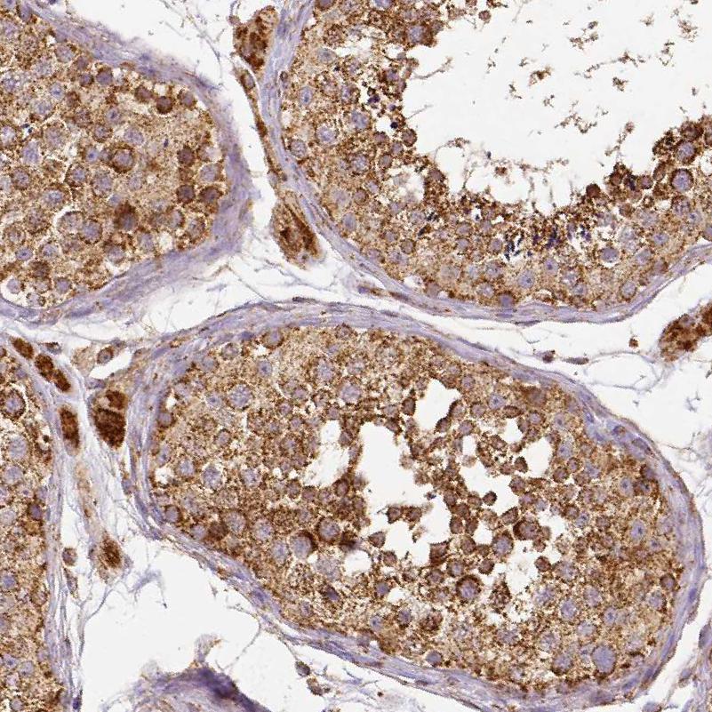 SDHB Antibody - BSA Free Immunohistochemistry-Paraffin: SDHB Antibody [NBP1-87069]