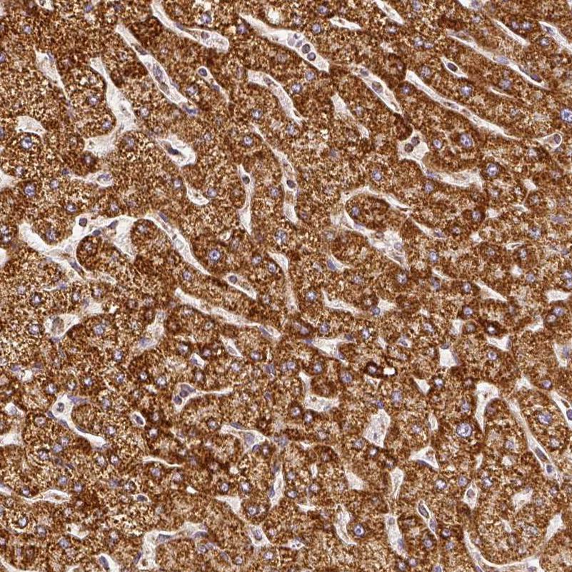 SDHB Antibody - BSA Free Immunohistochemistry-Paraffin: SDHB Antibody [NBP1-87069]