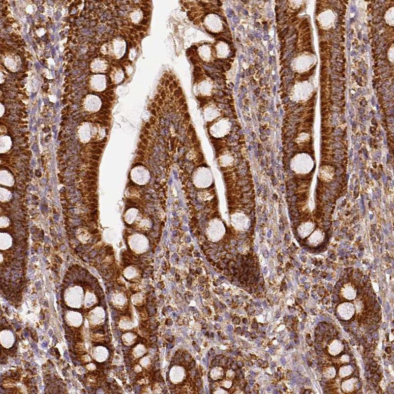 SDHB Antibody - BSA Free Immunohistochemistry-Paraffin: SDHB Antibody [NBP1-87069]